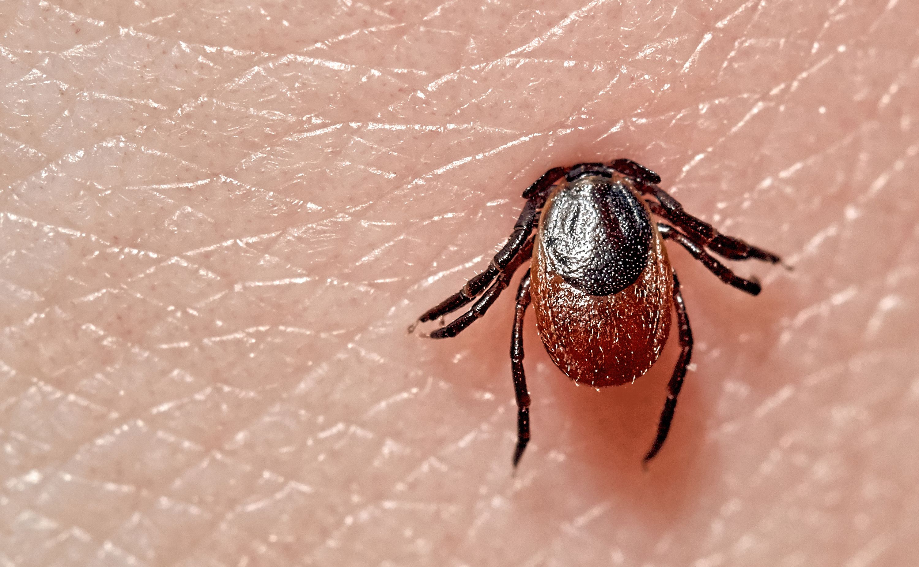 Rekordowa liczba zachorowań na boreliozę. Sprawdź, jak skutecznie się zabezpieczyć przed kleszczami