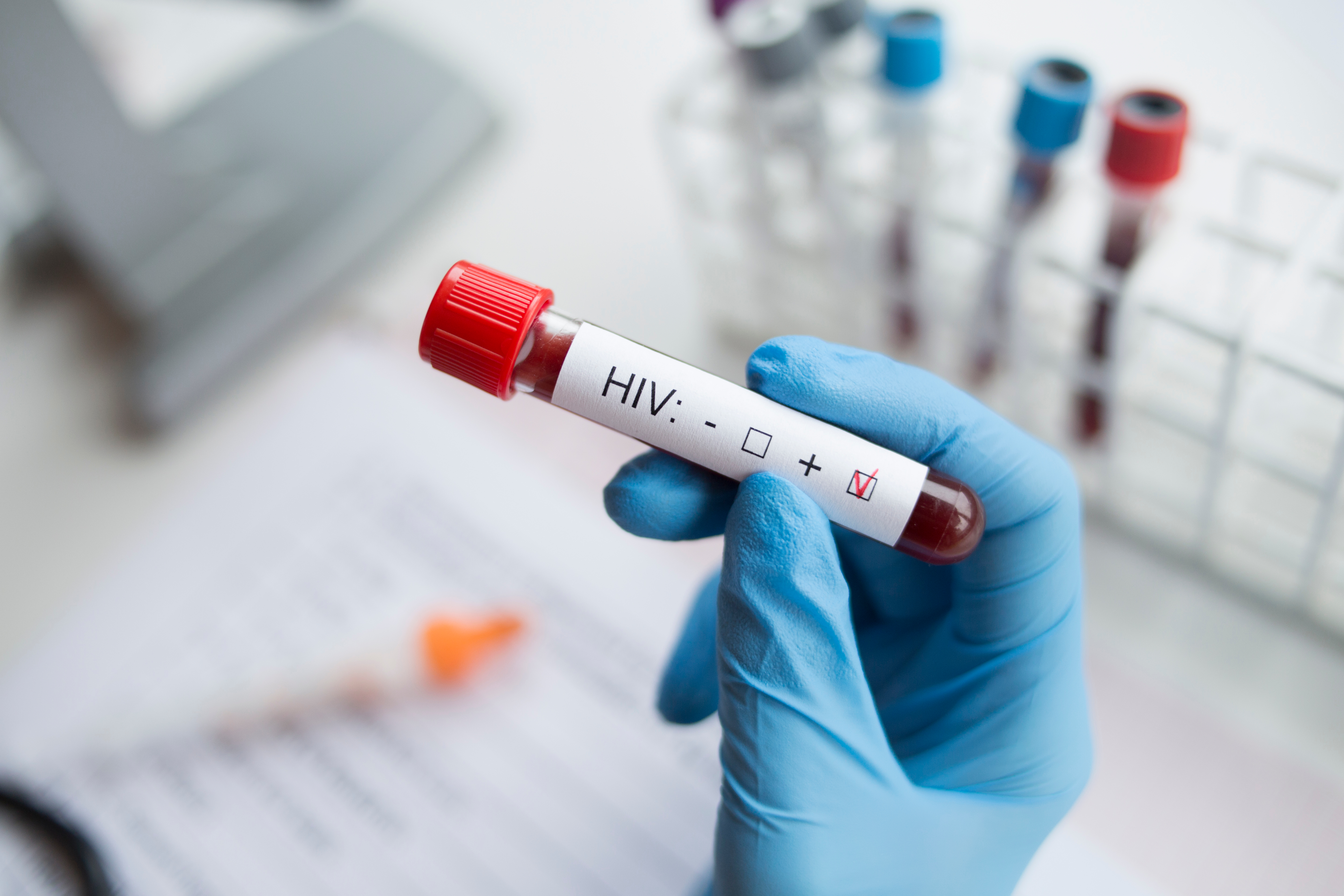 test HIV wirus HIV choroby przenoszone drogą płciową zdrowie publiczne profilaktyka HIV PrEP AIDS badania profilaktyczne punkty testowania HIV zakażenia STI