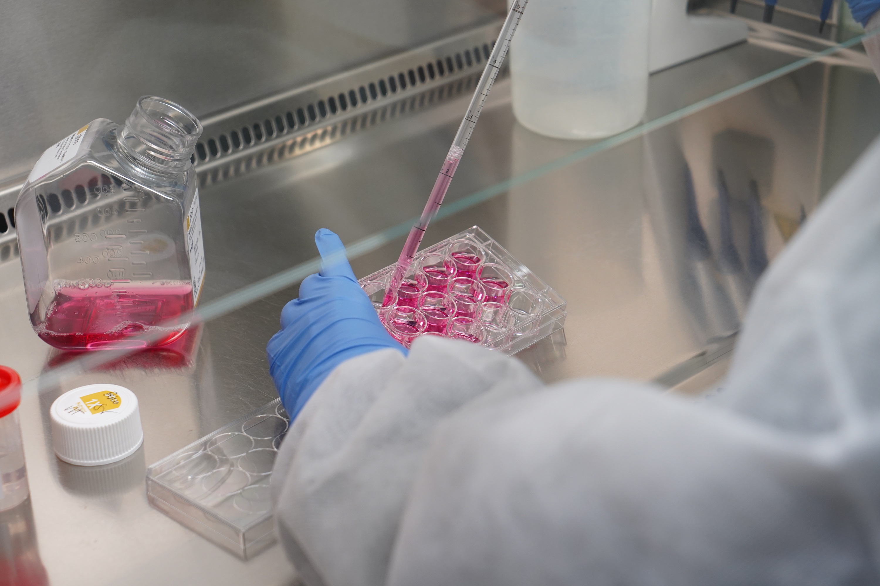 Choroby zakaźne i aktualna sytuacja epidemiologiczna w Polsce [RAPORT]
