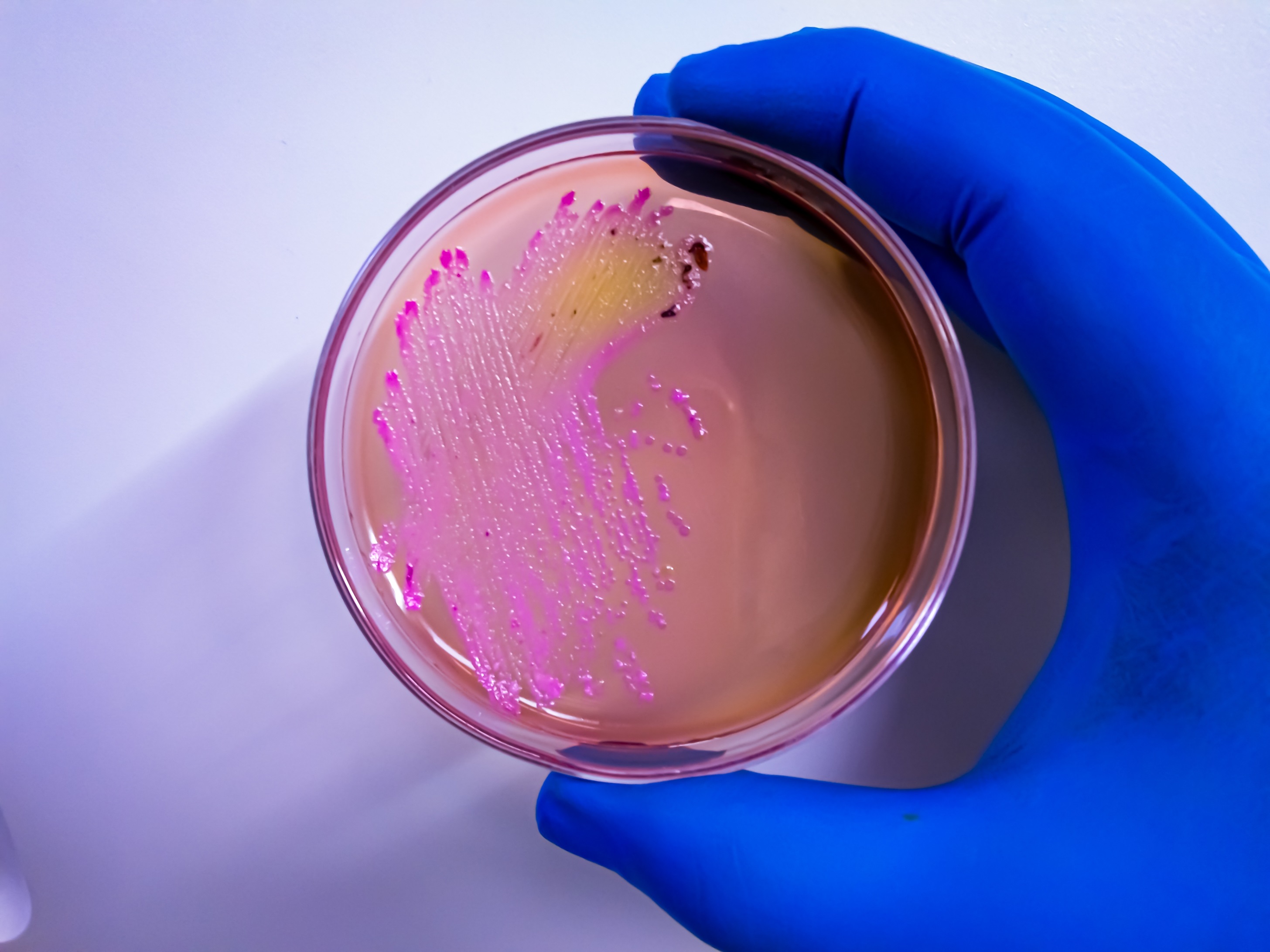 Powraca śmiertelna choroba, o której wielu już zapomniało. Bakteria mutuje szybciej, niż przewidywano