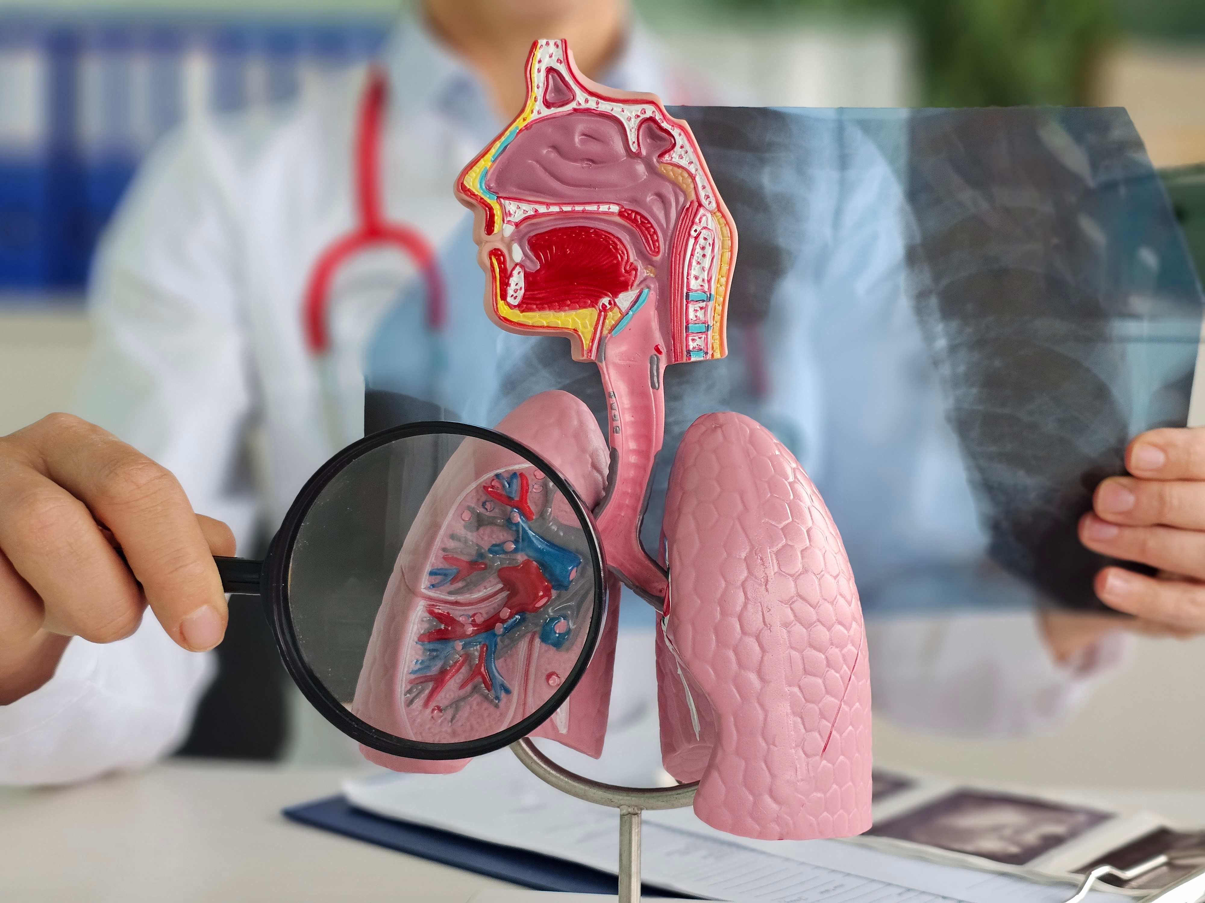 6 milionów Polaków cierpi na choroby płuc. Ta jest najczęstsza