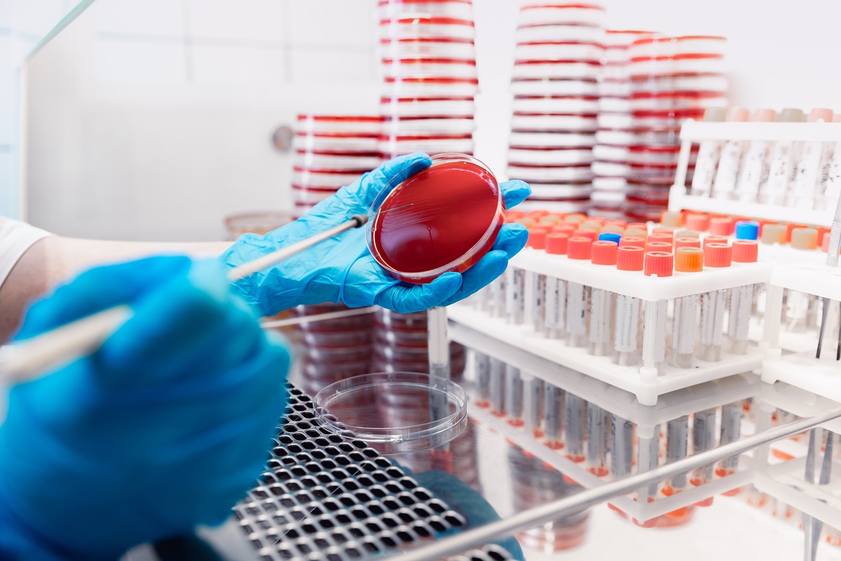 Sepsa - co to jest i jakie daje wczesne objawy? Potrzebny jest rejestr zachorowań